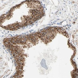 ENDOD1 Antibody, Novus Biologicals 0.1mL; Unlabeled:Antibodies, Polyclonal