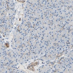 ENDOD1 Antibody, Novus Biologicals 0.1mL; Unlabeled:Antibodies, Polyclonal