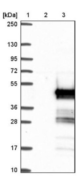 ENKD1 Antibody, Novus Biologicals 0.1 mL | Buy Online | Novus Biologicals | Fisher Scientific