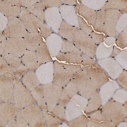 ENO3 Antibody, Novus Biologicals 25 &mu;L | Buy Online | Novus Biologicals | Fisher Scientific