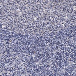 ENO3 Antibody, Novus Biologicals 25 &mu;L | Buy Online | Novus Biologicals | Fisher Scientific