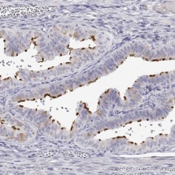 ENO4 Antibody, Novus Biologicals:Antibodies:Primary Antibodies