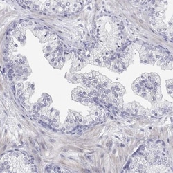 ENO4 Antibody, Novus Biologicals:Antibodies:Primary Antibodies