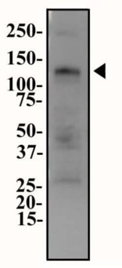 ENPP-1 Antibody - BSA Free, Novus Biologicals 0.025mL:Antibodies, Polyclonal