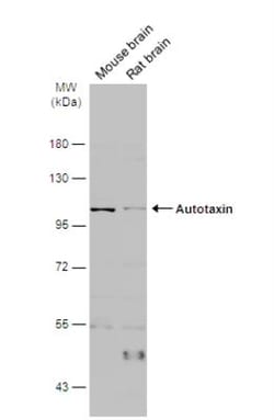 ENPP-2/Autotaxin Antibody, Novus Biologicals 0.1mL; Unlabeled:Antibodies,