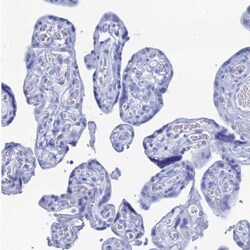 ENPP-3/CD203c Antibody, Novus Biologicals 0.1mL; Unlabeled:Antibodies,