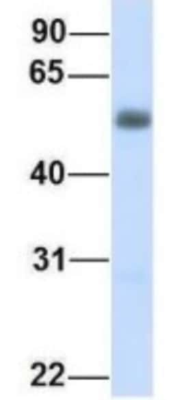 ENT2 Antibody, Novus Biologicals 0.05mg; Unlabeled:Antibodies, Polyclonal