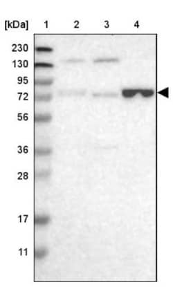 ENTPD4 Antibody, Novus Biologicals 25 &mu;L; Unlabeled:Antibodies, Polyclonal