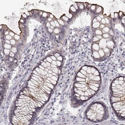 ENTPD8 Antibody, Novus Biologicals 25 &mu;L; Unlabeled:Antibodies, Polyclonal