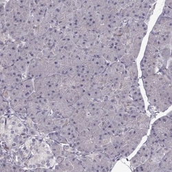 ENTPD8 Antibody, Novus Biologicals 25 &mu;L; Unlabeled:Antibodies, Polyclonal