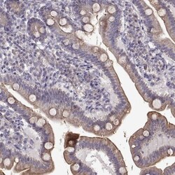ENTPD8 Antibody, Novus Biologicals 25 &mu;L; Unlabeled:Antibodies, Polyclonal
