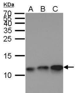 ENY2 Antibody (245), Novus Biologicals 0.1 mL | Buy Online | Novus Biologicals | Fisher Scientific