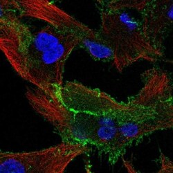 EPB41L1 Antibody, Novus Biologicals 25 &mu;L, Unlabeled:Antibodies, Polyclonal