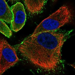 EPB41L1 Antibody, Novus Biologicals:Antibodies:Primary Antibodies