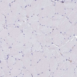 EPB41L1 Antibody, Novus Biologicals 25 &mu;L, Unlabeled:Antibodies, Polyclonal