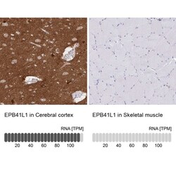 EPB41L1 Antibody, Novus Biologicals 25 &mu;L, Unlabeled:Antibodies, Polyclonal