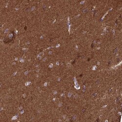 EPB41L1 Antibody, Novus Biologicals:Antibodies:Primary Antibodies