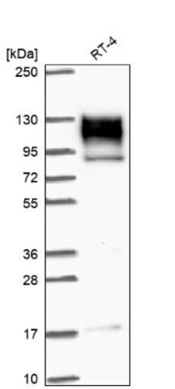 EPB41L1 Antibody, Novus Biologicals 25 &mu;L, Unlabeled:Antibodies, Polyclonal