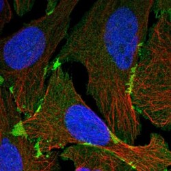 EPB41L3 Antibody, Novus Biologicals 25 &mu;L; Unlabeled:Antibodies, Polyclonal