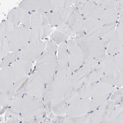 EPB41L3 Antibody, Novus Biologicals 25 &mu;L; Unlabeled:Antibodies, Polyclonal