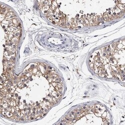 EPB41L3 Antibody, Novus Biologicals 25 &mu;L; Unlabeled:Antibodies, Polyclonal
