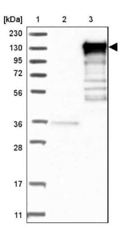 EPB41L3 Antibody, Novus Biologicals 25 &mu;L; Unlabeled:Antibodies, Polyclonal