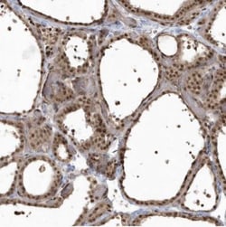 EPB41L4A Antibody, Novus Biologicals 25 &mu;L; Unlabeled:Antibodies, Polyclonal
