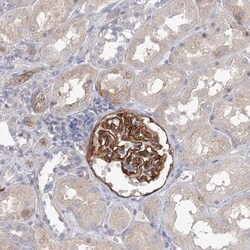 EPB41L5 Antibody, Novus Biologicals:Antibodies:Primary Antibodies