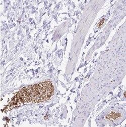 EPB42 Antibody, Novus Biologicals 0.1mL; Unlabeled:Antibodies, Polyclonal