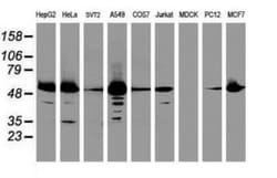 EPHX1 Antibody (OTI3F10), Novus Biologicals 0.1mL; Unlabeled:Antibodies,