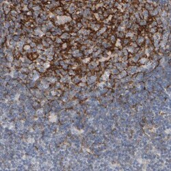 EPHX2 Antibody, Novus Biologicals 25 &mu;L; Unlabeled:Antibodies, Polyclonal