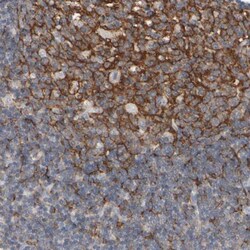 EPHX2 Antibody, Novus Biologicals:Antibodies:Primary Antibodies