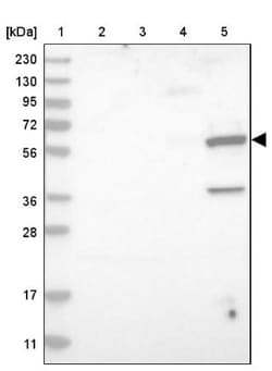 EPHX2 Antibody, Novus Biologicals 25 &mu;L; Unlabeled:Antibodies, Polyclonal