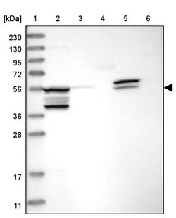 EPHX2 Antibody, Novus Biologicals:Antibodies:Primary Antibodies
