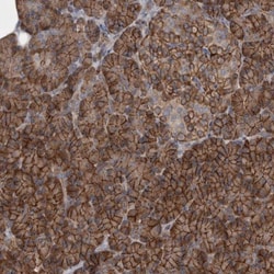 EPLIN Antibody, Novus Biologicals 25 &mu;L | Buy Online | Novus Biologicals | Fisher Scientific