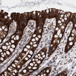 EPLIN Antibody, Novus Biologicals 25 &mu;L | Buy Online | Novus Biologicals | Fisher Scientific