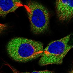 EPRS Antibody, Novus Biologicals 0.1mL; Unlabeled:Antibodies, Polyclonal