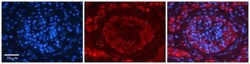 EPRS Antibody, Novus Biologicals 100&mu;L; Unlabeled:Antibodies, Polyclonal