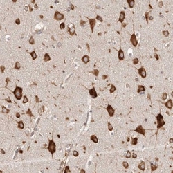 EPRS Antibody, Novus Biologicals 0.1mL; Unlabeled:Antibodies, Polyclonal