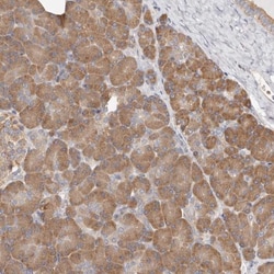 EPRS Antibody, Novus Biologicals 0.1mL; Unlabeled:Antibodies, Polyclonal
