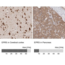 EPRS Antibody, Novus Biologicals 0.1mL; Unlabeled:Antibodies, Polyclonal