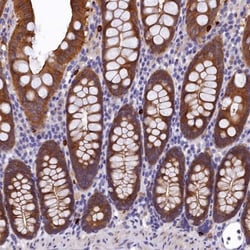 EPS8L2 Antibody, Novus Biologicals 0.1mL; Unlabeled:Antibodies, Polyclonal