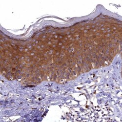 EPS8L2 Antibody, Novus Biologicals 0.1mL; Unlabeled:Antibodies, Polyclonal