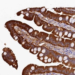 EPS8L2 Antibody, Novus Biologicals 0.1mL; Unlabeled:Antibodies, Polyclonal