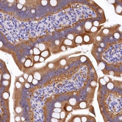 EPS8L2 Antibody, Novus Biologicals 0.1mL; Unlabeled:Antibodies, Polyclonal