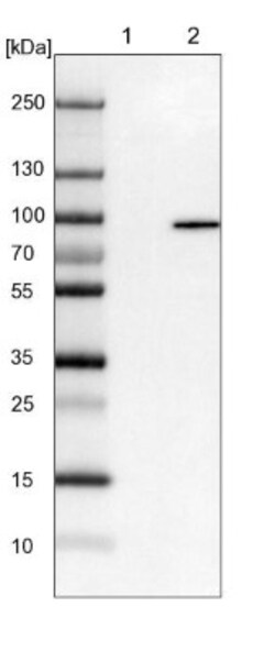 EPS8L2 Antibody, Novus Biologicals 0.1mL; Unlabeled:Antibodies, Polyclonal