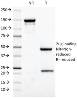ER alpha/NR3A1 Antibody (ESR1/420), Novus Biologicals:Antibodies:Primary