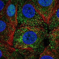 ER alpha/NR3A1 Antibody, Novus Biologicals:Antibodies:Primary Antibodies