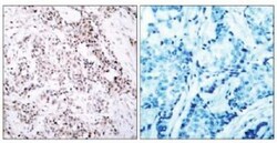 ER alpha/NR3A1 Antibody, Novus Biologicals 0.025 mL | Buy Online | Novus Biologicals | Fisher Scientific