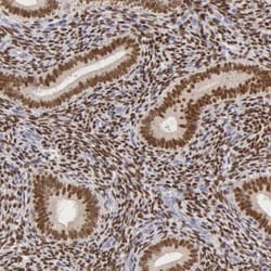 ER alpha/NR3A1 Antibody, Novus Biologicals 25 &mu;L; Unlabeled:Antibodies,